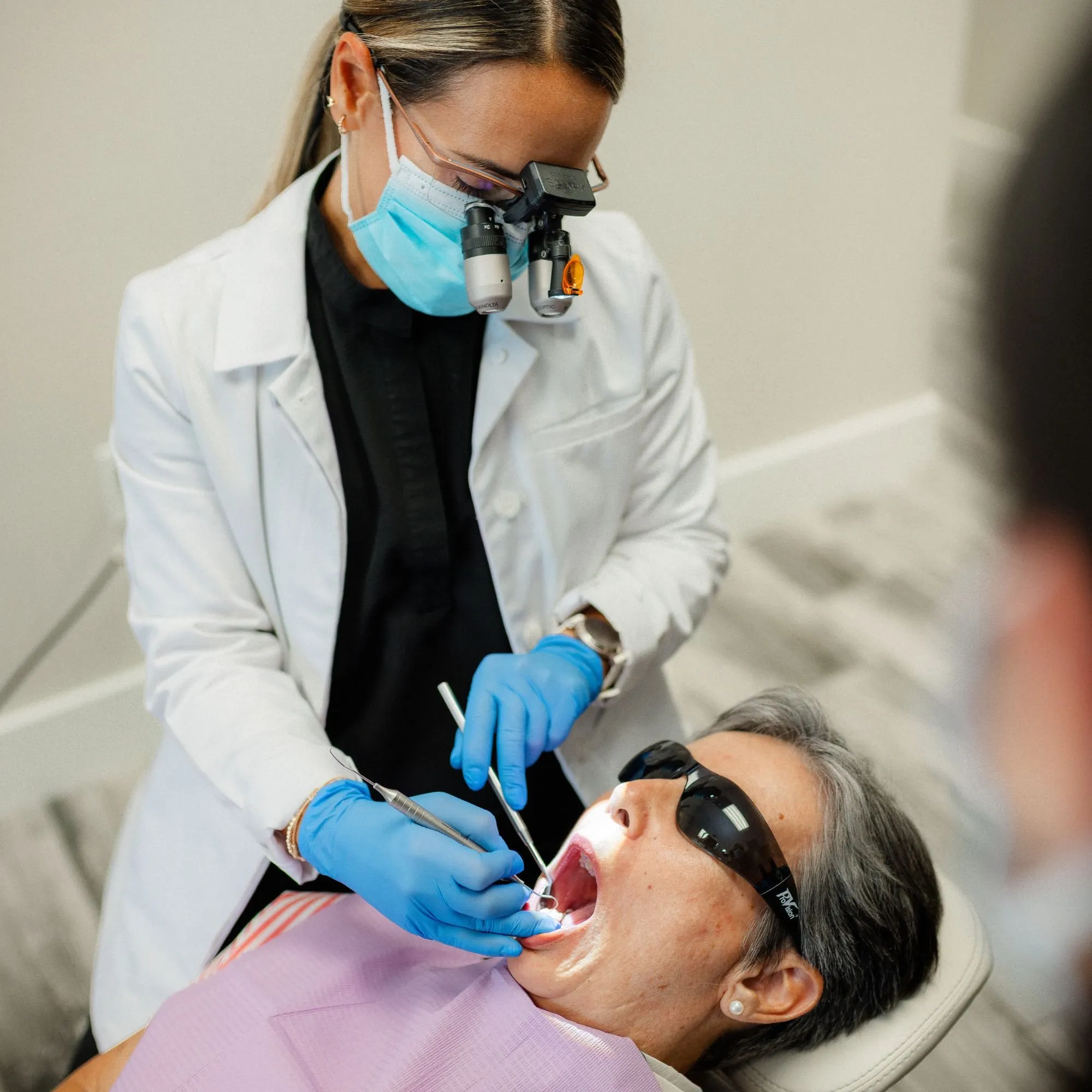 Dentist placing a tooth-colored filling using magnification loupes
