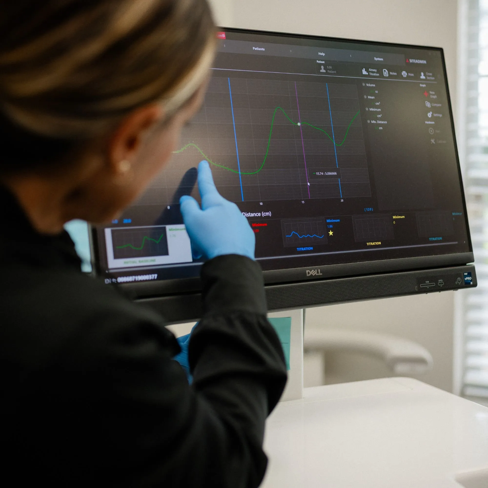 Reviewing home sleep study results on screen before fitting an oral appliance
